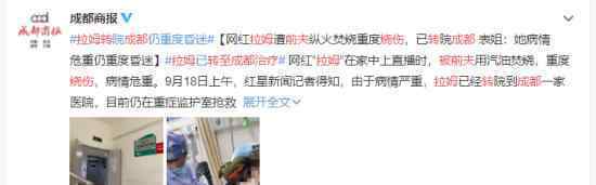 拉姆被前夫烧伤转至成都治疗 具体是什么情况