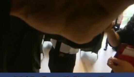 男子在餐厅吃红烧肉咬到硬物 吐出来究竟发生什么东西