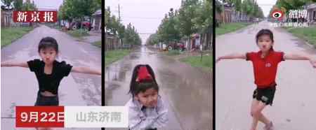 爱跳舞左脚畸形女孩接受公益救治 具体什么情况