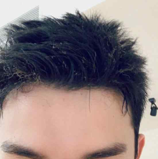 吴磊头发烧焦了 烧焦原因是什么?烧焦后长啥样?