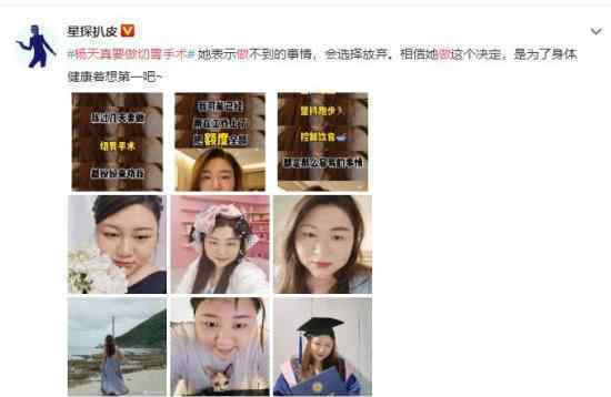 杨天真要做切胃手术 为了工作太拼了