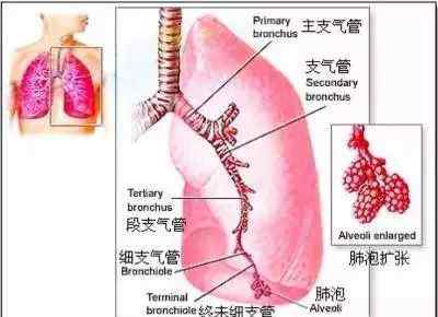 肺部听诊部位6个示意图 【收藏】医生必须掌握的肺部听诊技巧