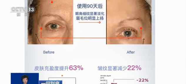 抗糖真能抗衰老吗 目前是什么情况？