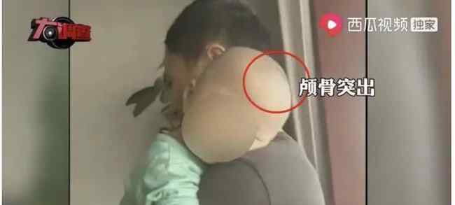 官方:未发现医生参与假奶粉事件 目前是什么情况？