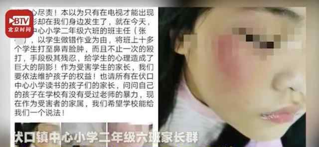 小学生写错字被老师打伤 面对家长质问竟然还反呛