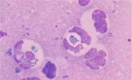 基因编辑清除HIV 真相到底是怎样的？