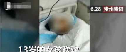 女孩被自家狗撕咬 目前是什么情况？