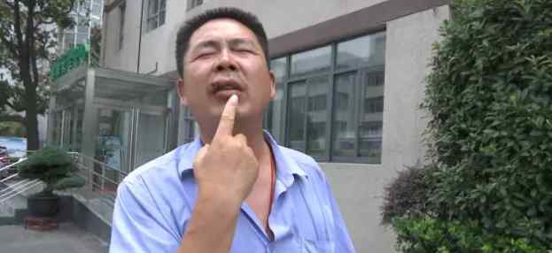 公交司机未及时让路被围殴 嘴巴缝了八针牙齿断了一颗