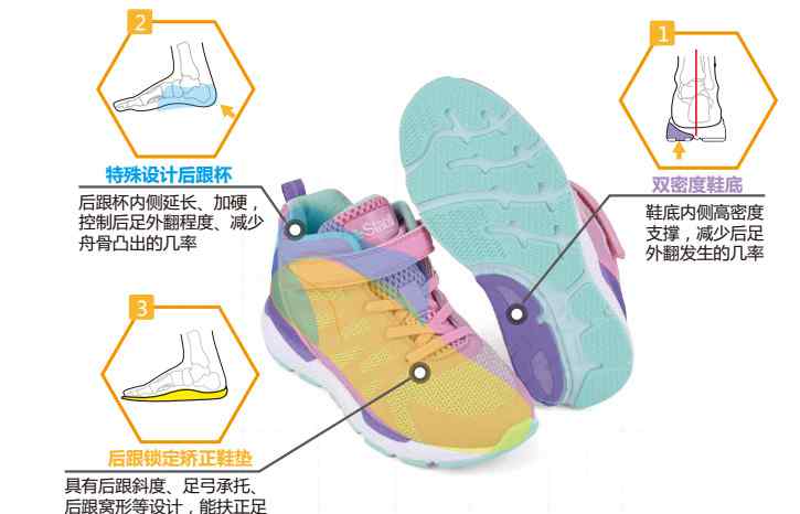 儿童矫正鞋垫不能随意买，需根据足部情况定制