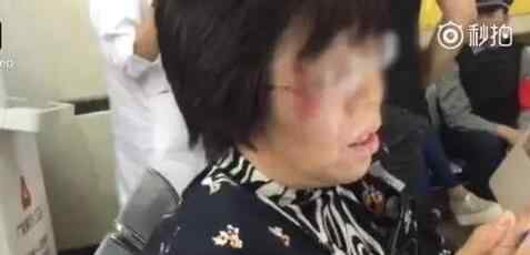 东航遇气流颠簸多人受伤 飞机遇到气流为什么会颠簸？
