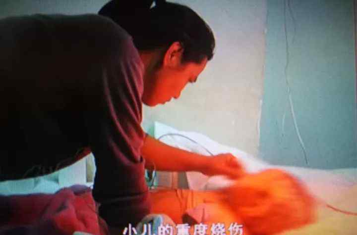 3岁女孩掉进热水锅 奶奶拽住双腿一把捞上来