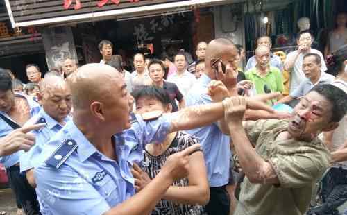 城管踢翻竹篮引起冲突 导致面馆老板头部和脸部受伤