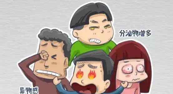 硫酸软骨素滴眼液 教你1秒分清：常见15种滴眼液的功效与卖点