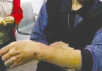 流浪狗连伤22人 居民需警惕