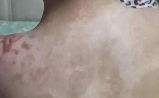 心理专家解读抚顺6岁女童被虐案 解读内容令人心情久久不能平复