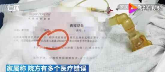 家属回应金龙泉创始人术后脑死亡 登上网络热搜了！