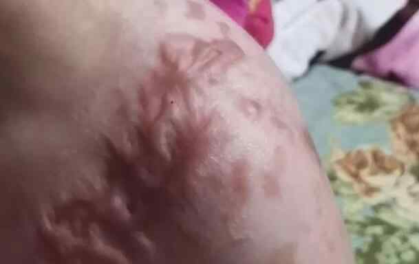 心理专家解读抚顺6岁女童被虐案 解读内容令人心情久久不能平复