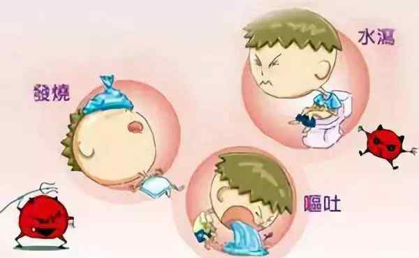 病毒性胃肠炎 轮状病毒、诺罗病毒、腺病毒，宝宝病毒性肠胃炎的三大元凶！