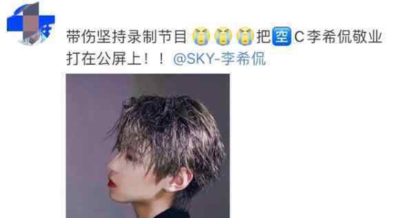 李希侃鼻子断了是怎么回事 后续情况怎么样了