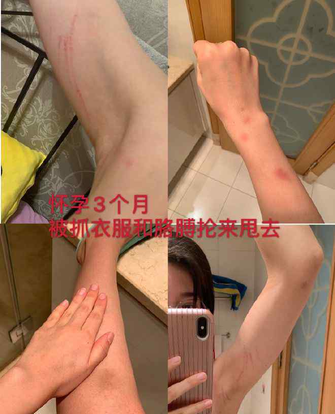 短跑名将张培萌被控诉家暴 事件细节完整回顾