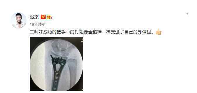 吴京晒谢楠桡骨钢钉照 手术很成功！很长一段时间在轮椅上度过