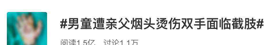 男童遭亲父烟头烫伤双手面临截肢，家里还有2个弟弟妹妹