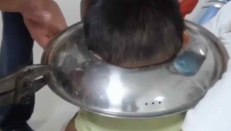男孩脑袋卡进锅盖取不下来 网友：原谅我忍不住笑了