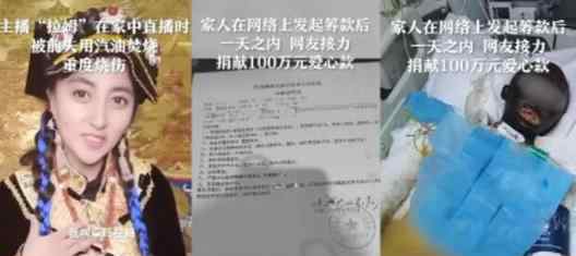 网红黑姑娘拉姆事件详情始末 被烧视频曝光