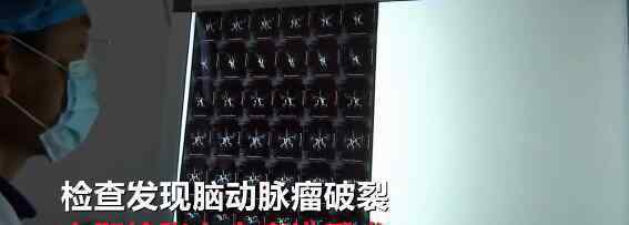 女子飙青藏高原致脑动脉瘤破裂 网友：飙个高音差点给自己送走！