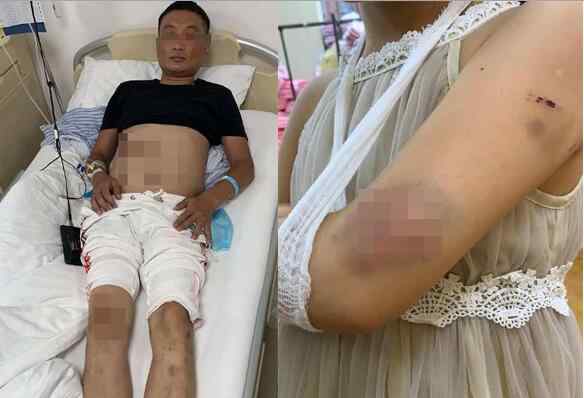 3岁女娃在家拍皮球被邻居找上门 家人开门瞬间恐怖的事发生