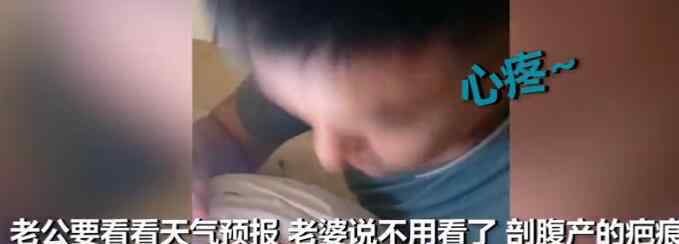 老婆剖腹产疤痕痒得厉害 老公开闪光灯仔细查看当场哭了