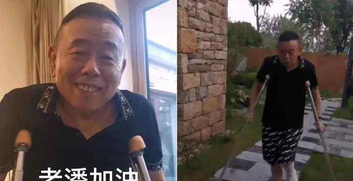 潘长江骨折跳无价之姐 潘叔左脚粉碎性骨折怎么回事