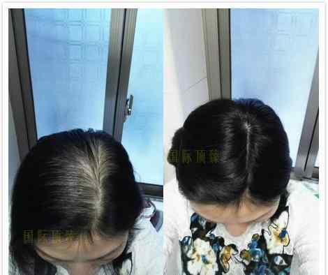 好的假发品牌 真发假发品牌哪个好？超逼真的国际顶臻高端品质假发品牌