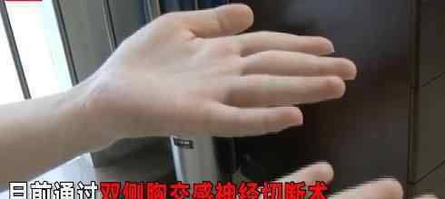 女孩手掌心常年“流汗如雨” 医生检查结果令人意想不到