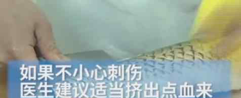 广东深圳一市民手上出现“大窟窿”急忙就诊 医生一看当场惊了