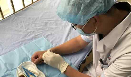 四川骨科大夫左手给右手做手术 具体怎么回事
