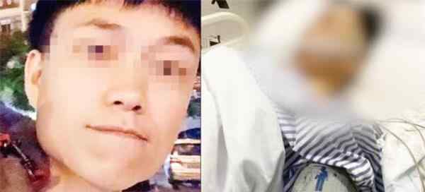 当事医院回应男子拔智齿后死亡 医院的责任有多大