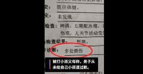 男子遭恶作剧电梯内暴打小孩 小孩被打视频泄露画面惨不忍睹