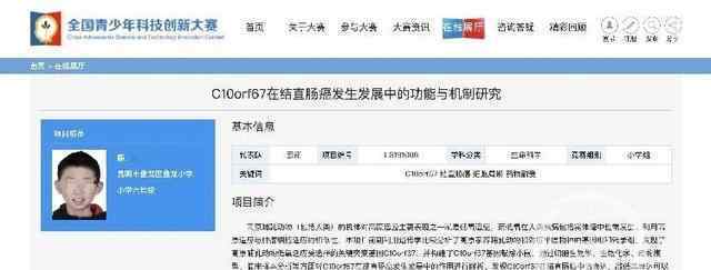 小学生研究基因获全国大奖引质疑什么情况 事件真相是什么