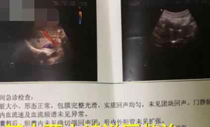 经期被罚吃辣条就医后遭劝退 公司称辞退理由是业绩不佳