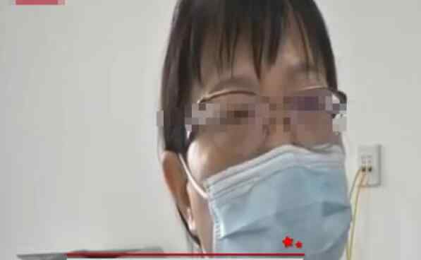 姐弟俩吃完消暑佳品浑身无力脸发白 医生的话让人警醒