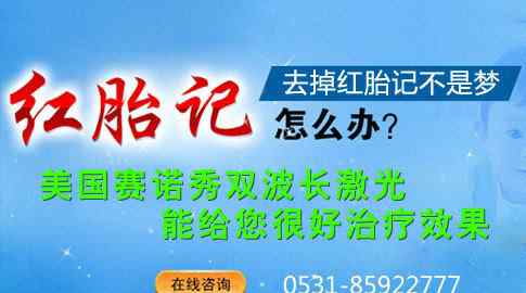 激光祛红胎记 激光去红胎记一般多少钱