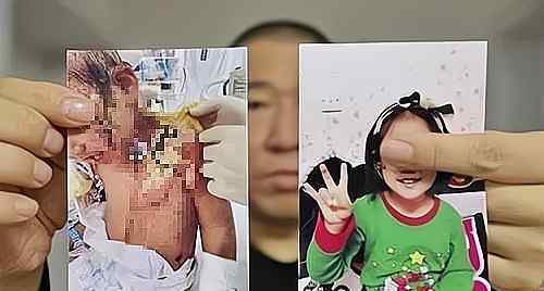 抚顺被虐女童首诊医生发声 医生说了什么被虐女童是否得到治疗