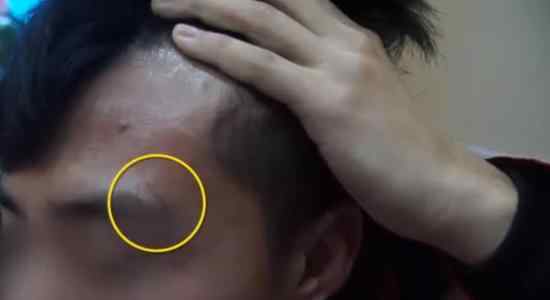 沈大学生亲述被打细节 这个沈大学生发生了什么事