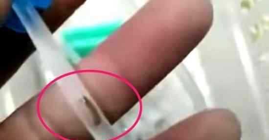 幼儿输液时疑有虫是怎么回事医院回应了吗（图）