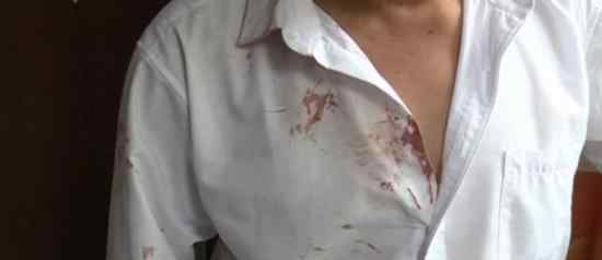 佛山男子遭妻子家暴什么情况事情具体经过是