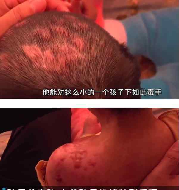 抚顺市回应6岁女童受虐案：将依法严惩被告 孩子却懂事的让人心疼 事情始末回顾