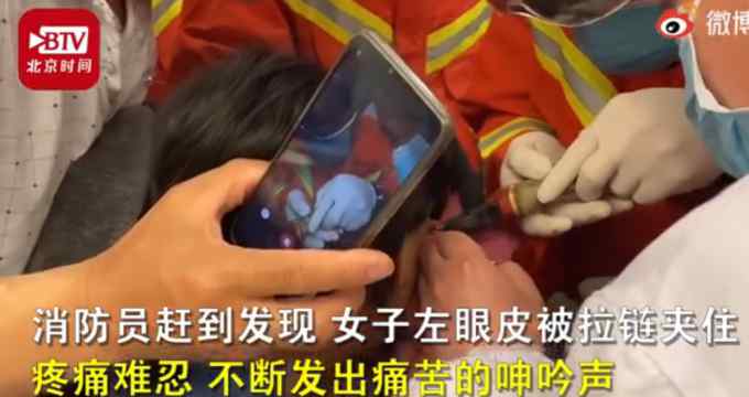 女子眼皮被拉链夹住求助消防 画面吓人！网友：鸡皮疙瘩起来了