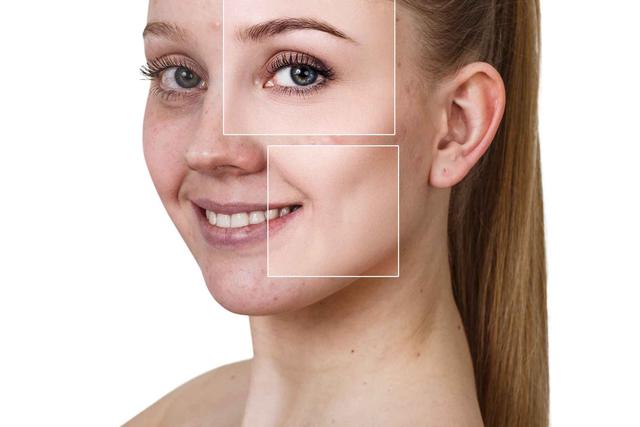 脸上色斑怎么去除 消除脸上的色斑，5种健康的方法愿你坚持，或成功消色斑