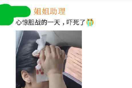 黄圣依拍戏时头部受伤 究竟发生了什么